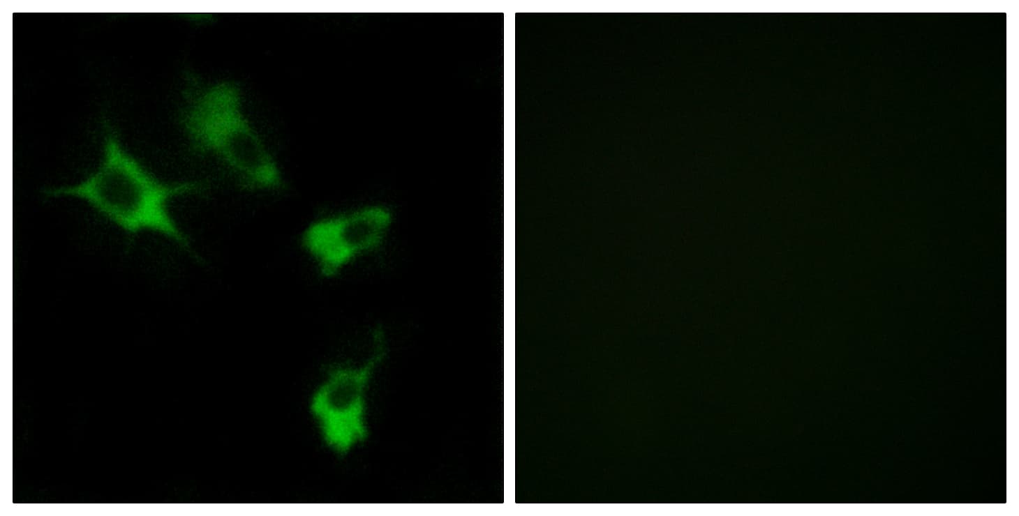 MAST4 Antibody (aa251-300)