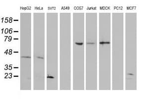 UBE2E3 Antibody (clone OTI4G4, Carrier-free)