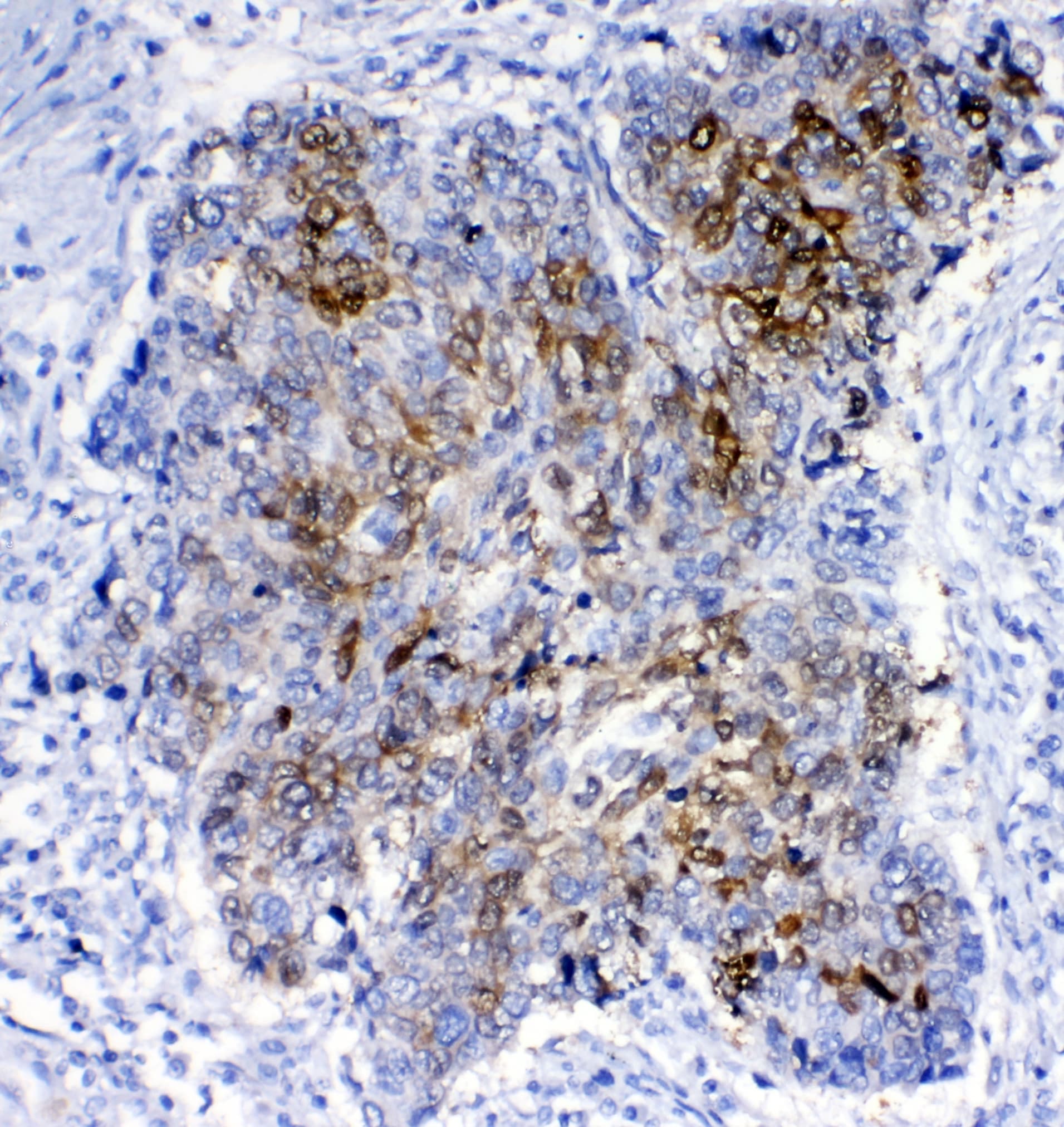 GSTA1+GSTA2+GSTA3+GSTA4+GSTA5 Antibody