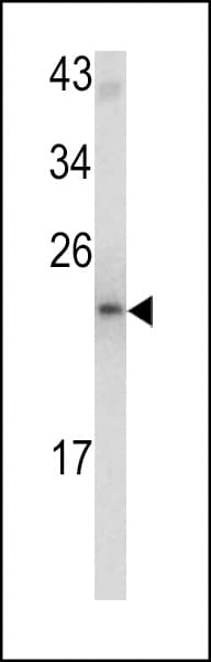 MCTS1 Antibody (aa1-30)