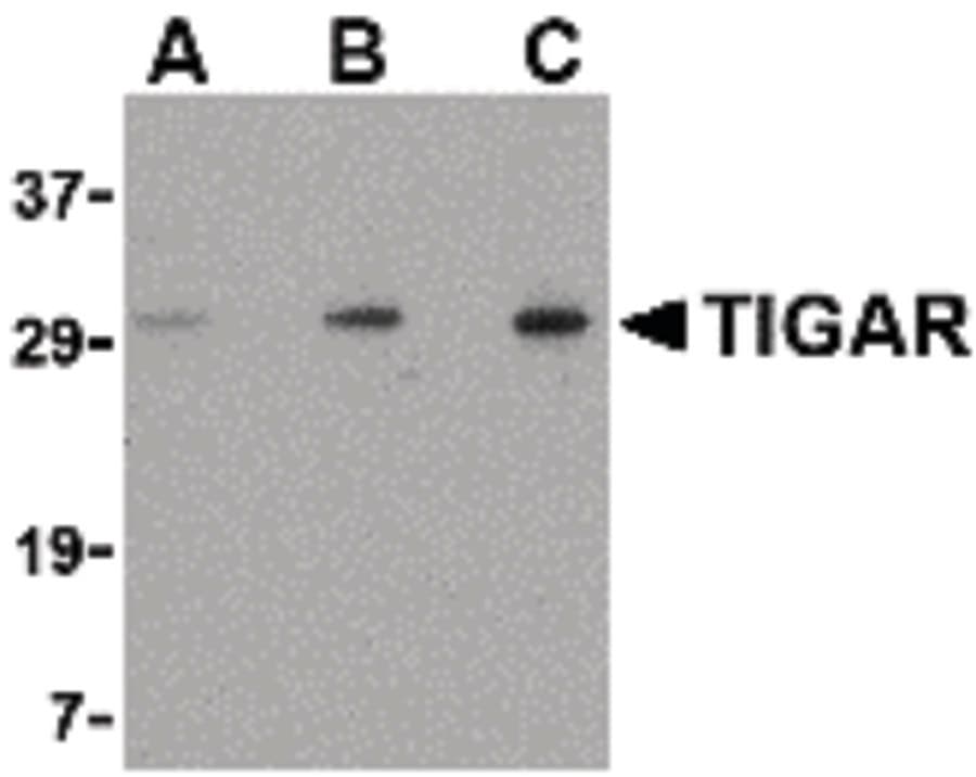 IHC-plus™ TIGAR Antibody