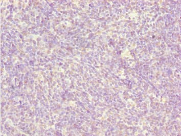 BCAS3 Antibody