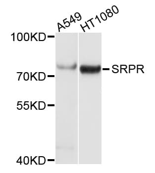 Polyclonal Rabbit anti-Human SRPR Antibody (WB)