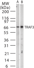IHC-plus™ Polyclonal Rabbit anti-Human TRAF3 Antibody (aa323-340, IHC, WB)