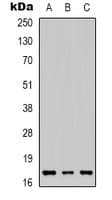 IL-1B / IL-1 Beta Antibody (Internal)