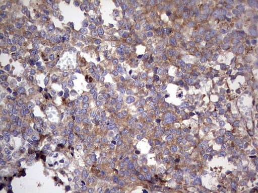Polyclonal Rabbit anti-Human RELA / NFKB p65 Antibody (aa100-170, IHC, WB)