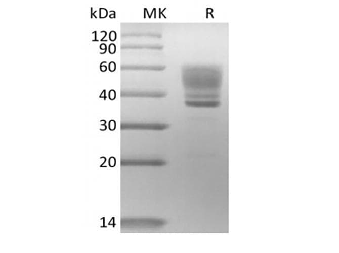 Human IL13 Protein (Recombinant Mouse IgG Fc, C-terminus)