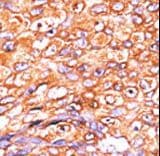 DUSP10 / MKP5 Antibody (aa1-30)
