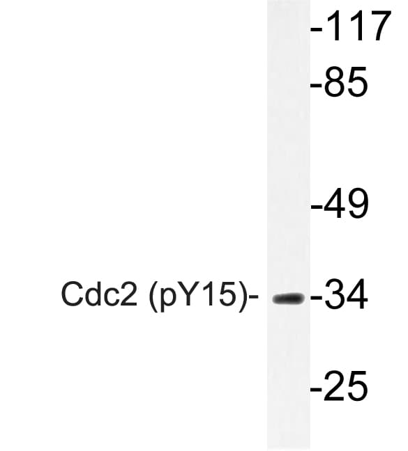 CDK1 / CDC2 Antibody (phospho-Tyr15)