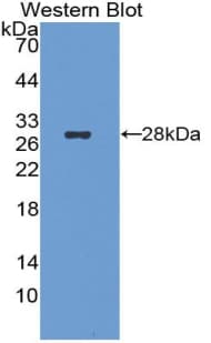 STC2 / Stanniocalcin 2 Antibody (aa53-294)