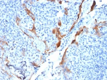 Monoclonal Mouse anti-Human KRT16 / CK16 / Cytokeratin 16 Antibody (clone KRT16/1714, Ready-to-Use, IHC)