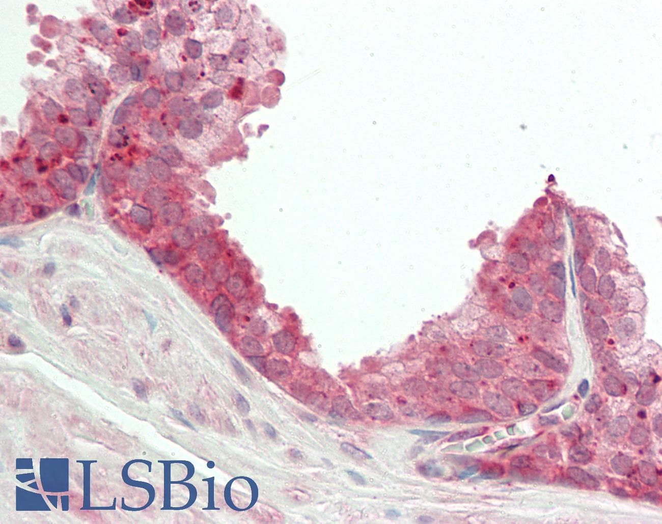 NEK2 Antibody (aa130-179)