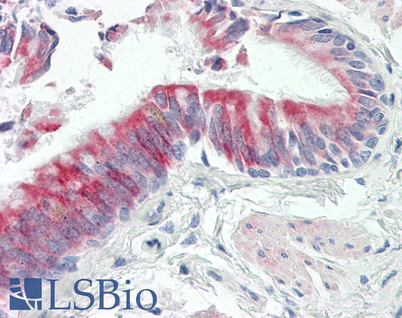 IHC-plus™ Polyclonal Rabbit anti-Human TRAPPC6A Antibody (aa31-80, IHC)