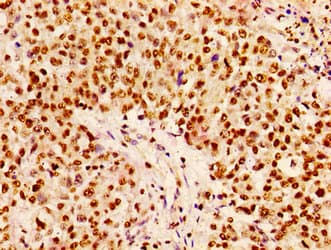 HIST1H1B Antibody