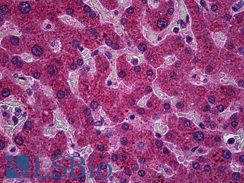 IHC-plus™ PPM1A / PP2CA Antibody (clone 4E11)