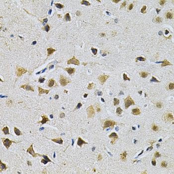 LGALS3 / Galectin 3 Antibody