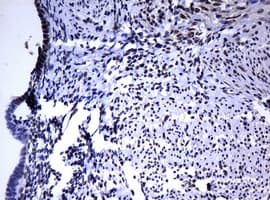 Monoclonal Mouse anti-Human PCNA Antibody (clone OTI1D11, IHC, WB)