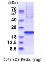 Human YIF1B Protein (Recombinant His)