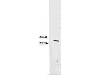 RFP / Red Fluorescent Protein Antibody