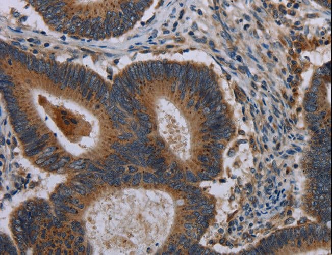 Polyclonal Rabbit anti-Human MAP3K11 / MLK3 Antibody (IHC, WB)