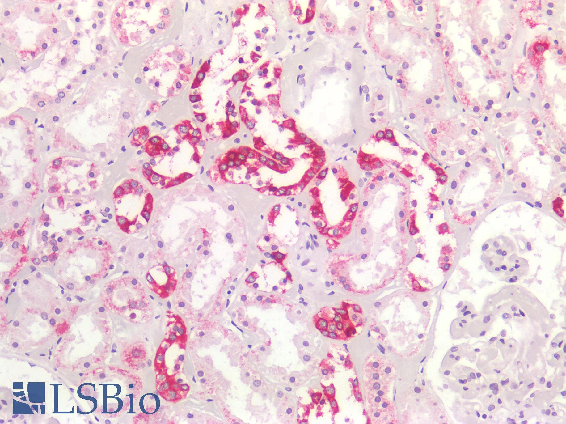 PathPlus™ KRT4 / CK4 / Cytokeratin 4 Antibody (clone 5H5)