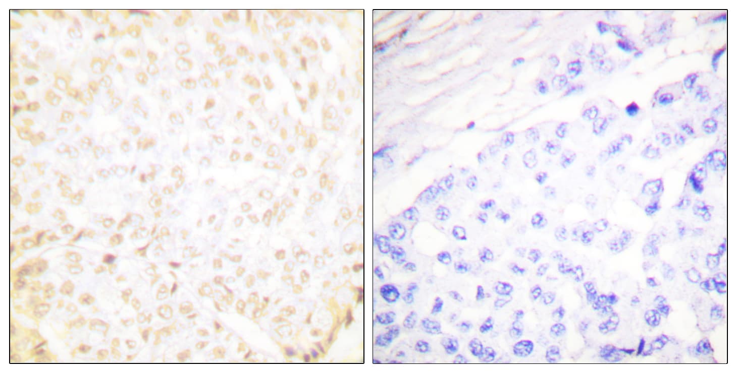 Polyclonal Rabbit anti-Human XRCC5 / Ku80 Antibody (aa683-732, IHC, WB)