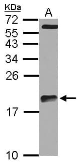 Polyclonal Rabbit anti-Human ARPC5L Antibody (IHC, WB)