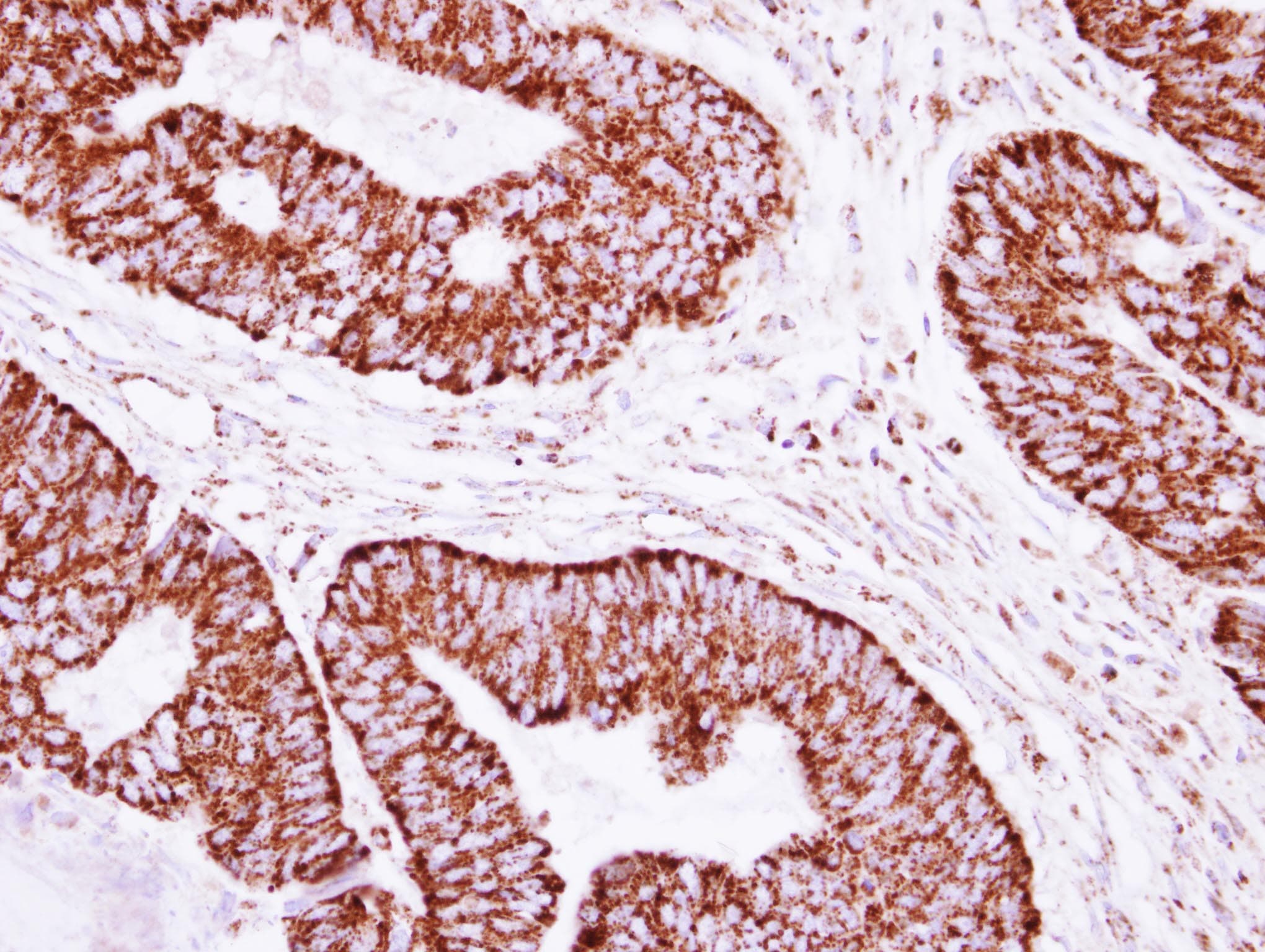 CLPP Antibody