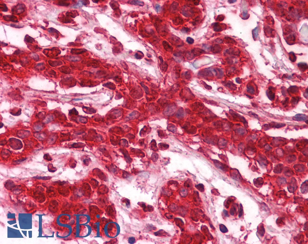 IHC-plus™ CLIC1 / NCC27 Antibody (clone 3F9)