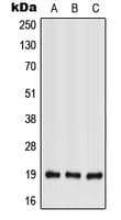 Polyclonal Rabbit anti-Human IFNL2 / IL28A Antibody (Internal, WB)