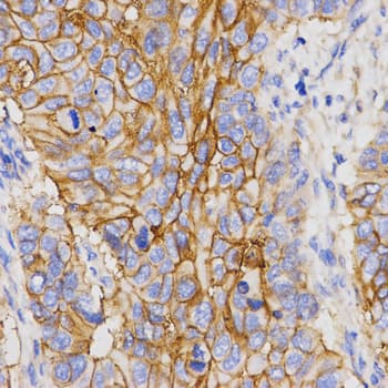 PGC / Pepsin C Antibody