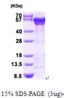 Human CALR / Calreticulin Protein (Recombinant His)