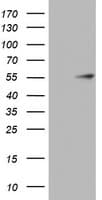 Monoclonal Mouse anti-Human KRT20 / CK20 / Cytokeratin 20 Antibody (clone OTI10D5, WB)