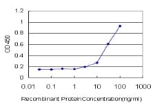 Monoclonal Mouse anti-Human PSMB6 Antibody (clone 2A3-5A8, IHC, WB)