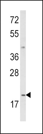 IHC-plus™ IL12A / p35 Antibody (aa168-195)