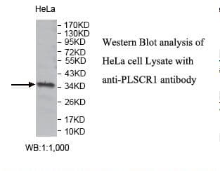 Polyclonal Rabbit anti-Human Scramblase / PLSCR1 Antibody (aa134-300, IHC, WB)