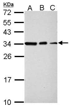 Polyclonal Rabbit anti-Human SET / TAF-I Antibody (aa1-45, IHC, WB)