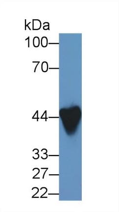 CARP / ANKRD1 Antibody (aa5-279, Biotin)
