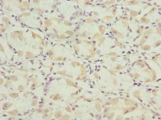 Polyclonal Rabbit anti-Human NGFRAP1 / NADE / Bex Antibody (IHC)