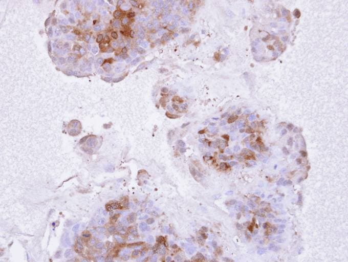 Polyclonal Rabbit anti-Human CD121b / IL1R2 Antibody (aa172-398, IHC, WB)