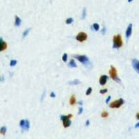 FOXE3 Antibody (Internal)