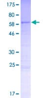 Human CCDC74B Protein (Recombinant GST)