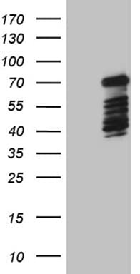 DCP1B Antibody (aa167-473, clone OTI1C5)