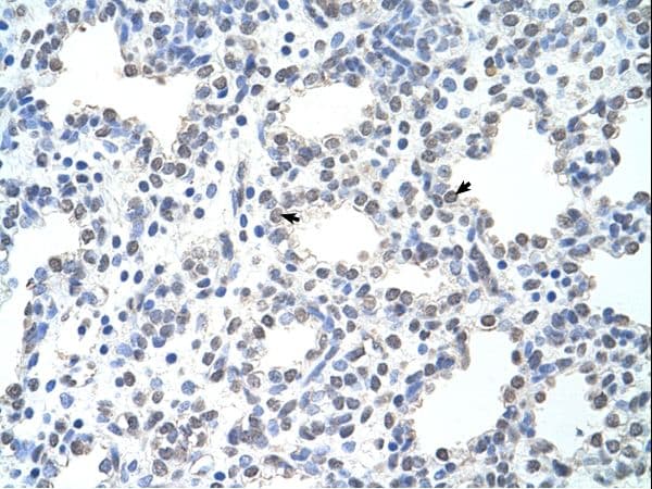 MCM6 Antibody (C-Terminus, Biotin)