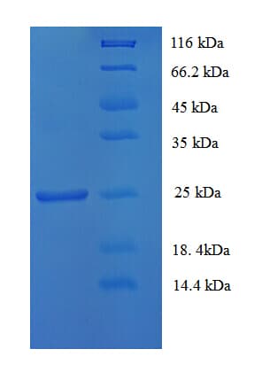 Human CD81 Protein (Recombinant His-SUMO)