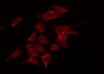 KDR / VEGFR2 / FLK1 Antibody (phospho-Tyr1059)