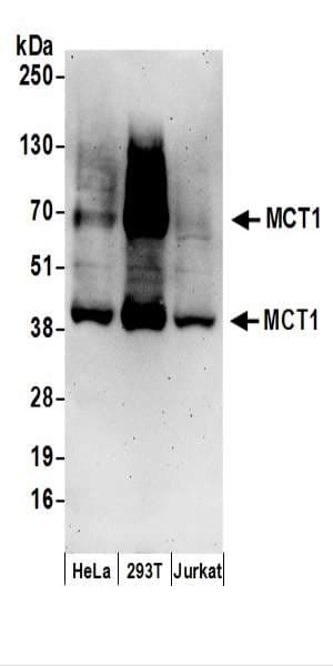Polyclonal Rabbit anti-Human SLC16A1 / MCT1 Antibody (aa450-500, IHC, WB)