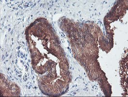 ECI2 / PECI Antibody (clone OTI1C8)
