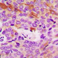 Polyclonal Rabbit anti-Human COL4A5 / Collagen IV Alpha5 Antibody (N-Terminus, IHC, IF, WB)