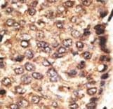 MMP24 Antibody (aa396-425)